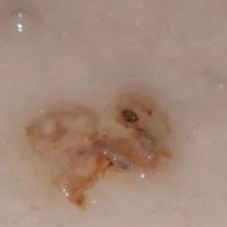 Sarıyer Kolasında Akrebe Benzeyen Canlı Bulunması Sağlık Riski Ve Hijyen İhlali