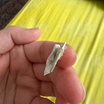 Badem Ezmesi İçindeki Plastik Parça Sağlık Riskine Yol Açtı