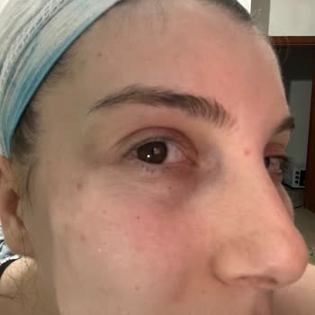 Randevu Gecikmesi Ve Kalitesiz Kaş İşlemi Nedeniyle 600 TL İade Talebi