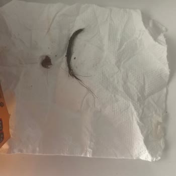 A101 Kayseri Talas Şubesinde Bonfilet Kavurmasında Yabancı Kıl Ve Sağlık Tehlikesi