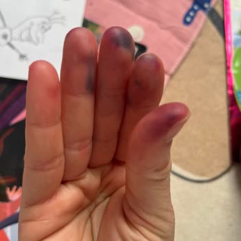 Çocuk Kaleminde Boya İzlerinin Çıkarılamaması Ve Açık Uyarı Gerekliliği