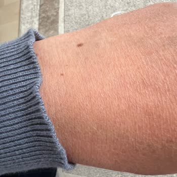 İki Günlük Ürün Aniden Bozuldu Mağazadan Cevap Yok