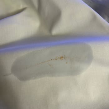 Buharlı Ütünün Tekrarlayan Arızası Ve Çözüm Bulunamaması Nedeniyle İade Talebi