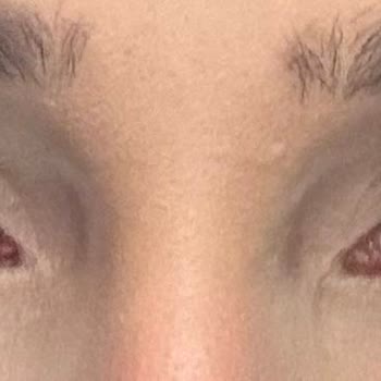 Yanlış Adres Ve Kalitesiz Kirpik Hizmeti Nedeniyle Ücret İadesi Ve Düzeltme Talebi