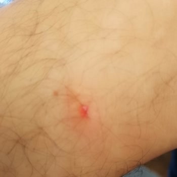 Kremlin Palace Otelinde Tahta Kuruları Nedeniyle Hijyen Sorunu Ve Şikayet Yanıtsızlığı