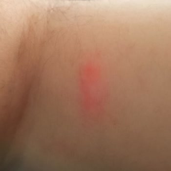 Kremlin Palace Otelinde Tahta Kuruları Nedeniyle Hijyen Sorunu Ve Şikayet Yanıtsızlığı