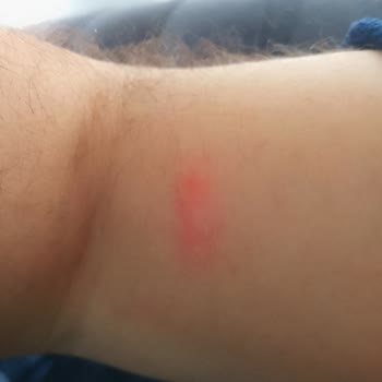 Kremlin Palace Otelinde Tahta Kuruları Nedeniyle Hijyen Sorunu Ve Şikayet Yanıtsızlığı