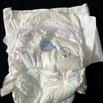 Molfix 6 Numaralı Bebek Bezinde Pişik Ve Sahte Ürün Şüphesi