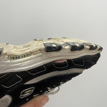 Skechers Ayakkabısının Altı Ayda Kenar Yırtılması Üretim Hatası Olarak Reddedildi