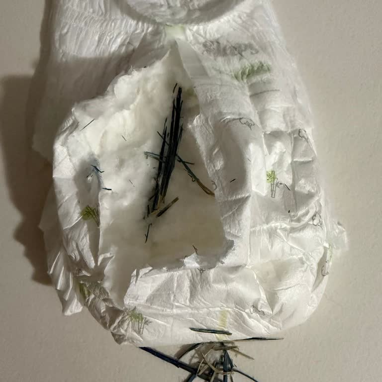 Yabancı Madde İçeren Bebek Bezinde Hijyen Ve Sağlık Endişesi