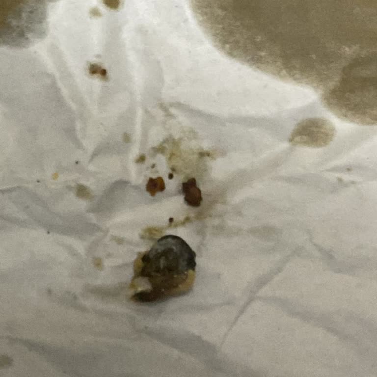 Canlı Salyangozlu Lahmacun Siparişinde Hijyen Skandalı Ve İade Talebi