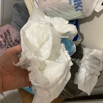 Molfix Bebek Bezinde Üretim Hatası Ve Güven Kaybı: Para İadesi Talebi