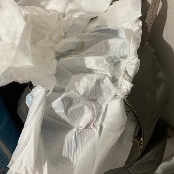 Molfix Bebek Bezinde Üretim Hatası Ve Güven Kaybı: Para İadesi Talebi