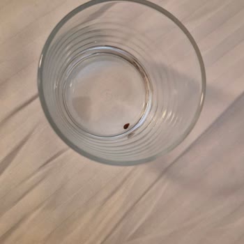 Ramada Encore Otelinde Tahta Kuruşu Nedeniyle Hijyen İhlali Ve Ücret İadesi Talebi