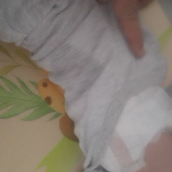 Molfix Premium Smart Fit Bebek Bezinde Yetersiz Emicilik Ve Sızıntı Şikayeti