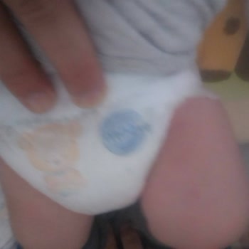 Molfix Premium Smart Fit Bebek Bezinde Yetersiz Emicilik Ve Sızıntı Şikayeti