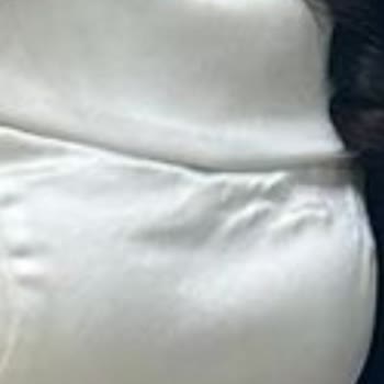 Nişan Gününde Kusurlu Abiye Ve Kuru Temizleme Sorunu