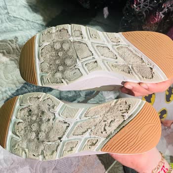 Skechers Ayakkabım 10 Kez Kullanıldı Tabanda Soyulma Değişim Talebi