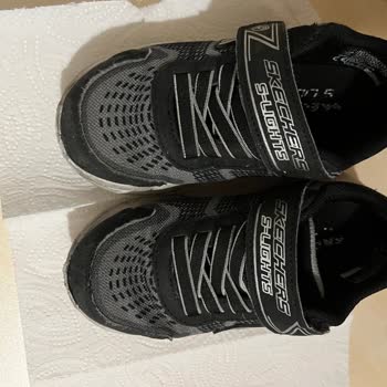 Skechers Çocuk Ayakkabısının Ön Kısmının Açılması Ve Deforme Olması