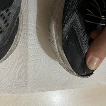 Skechers Çocuk Ayakkabısının Ön Kısmının Açılması Ve Deforme Olması