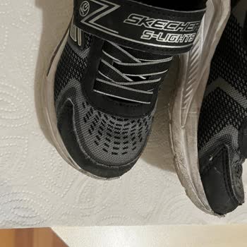 Skechers Çocuk Ayakkabısının Ön Kısmının Açılması Ve Deforme Olması