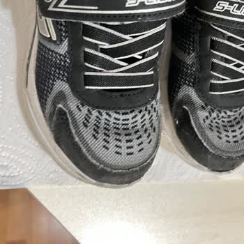 Skechers Çocuk Ayakkabısının Ön Kısmının Açılması Ve Deforme Olması