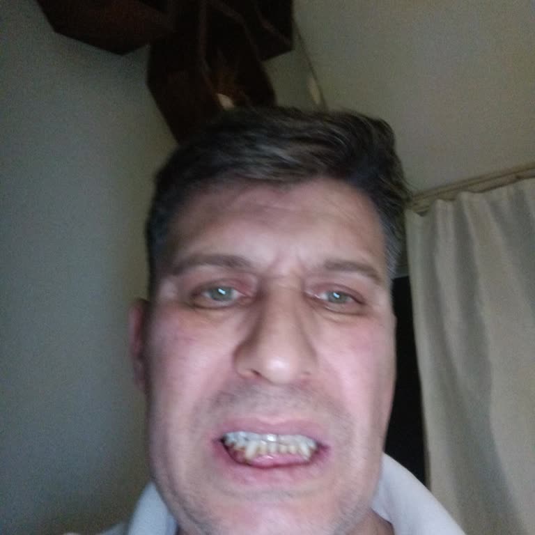 Acil Diş Ağrısı İçin Operatöre Bağlanamama Ve Randevu İsteği