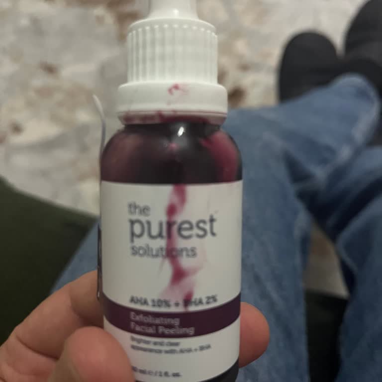 Trendyol’da Tekrarlanan Kırık Ürün Ve Uzayan İade Bekleyişi