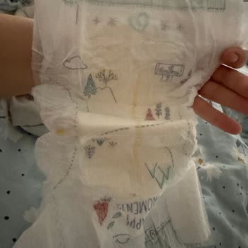 Prima Harmonie Bebek Bezlerinde Çiş Ve Kaka Cebinin Eksik Olması