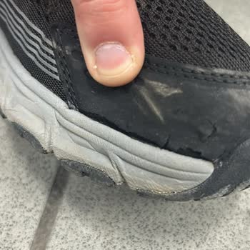 Garanti Kapsamına Rağmen 6 Ayda Yan Açılan Ayakkabı Ve Fiziki İnceleme Reddi