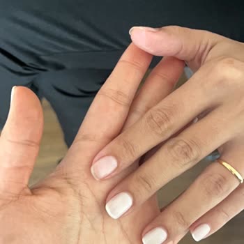 Kalıcı Oje Kısa Sürede Dökülmesi Ve İade Talebi