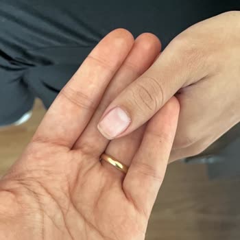 Kalıcı Oje Kısa Sürede Dökülmesi Ve İade Talebi