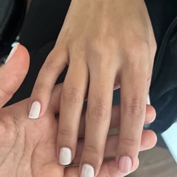 Kalıcı Oje Kısa Sürede Dökülmesi Ve İade Talebi