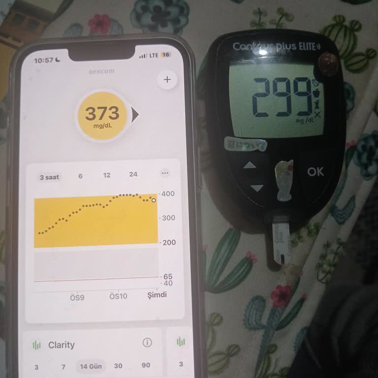 Dexcom G7 Sensör Ölçüm Farkları Ve Müşteri Destek Sorunu
