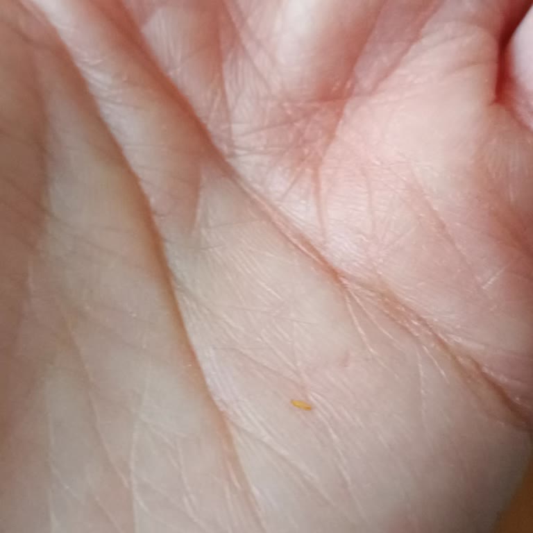 Cumhuriyet Sucuğunda Sert Parçalar Çıktı, İade Ve Kalite Kontrol Talebi