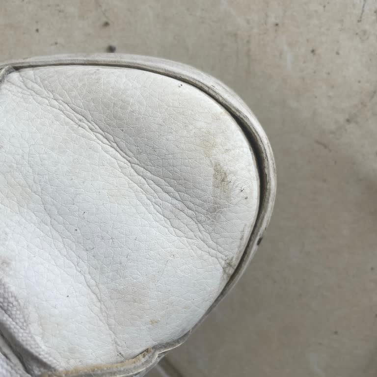 Adidas Ayakkabısındaki Açılma Ve Amazon-Adidas Yönlendirme Sorunu