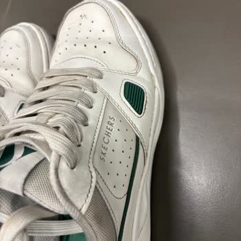 Skechers Ayakkabısında Boya Çözülmesi Ve Kullanıcı Hatası İddiasına Karşı İade Talebi