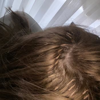 Saç Rengi Hatası Ve Ağrılı Kaynak İşlemi İçin 15 Bin TL İade Talebi