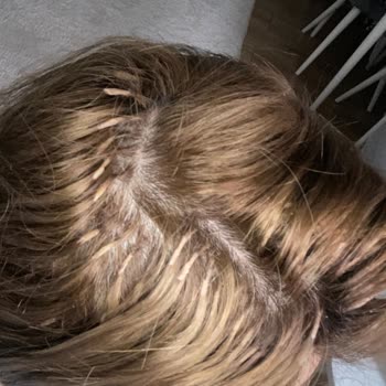 Saç Rengi Hatası Ve Ağrılı Kaynak İşlemi İçin 15 Bin TL İade Talebi