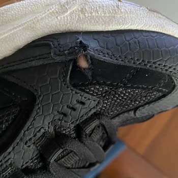 Skechers Ayakkabım Kısa Sürede Yırtıldı Ve Üretim Hatası İddiası Kabul Edilmiyor