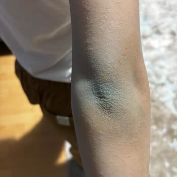 Zara Kanvas Cekette Boya Verdiği İçin Bayramı Mahvetti, İade Teklifi Yetersiz