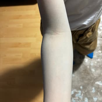 Zara Kanvas Cekette Boya Verdiği İçin Bayramı Mahvetti, İade Teklifi Yetersiz