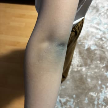 Zara Kanvas Cekette Boya Verdiği İçin Bayramı Mahvetti, İade Teklifi Yetersiz