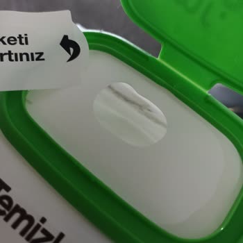 Uzun Son Kullanma Tarihli Mr. Green Havlusunda Küf Ve Hijyen Sorunu