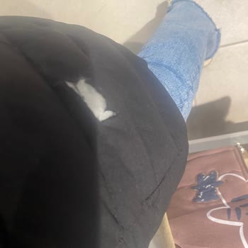 Sivri Merdiven Korkuluğu Montumu Yırtarak Mağdur Etti, Tam Tazminat Ve Güvenlik İyileştirmesi Talebi