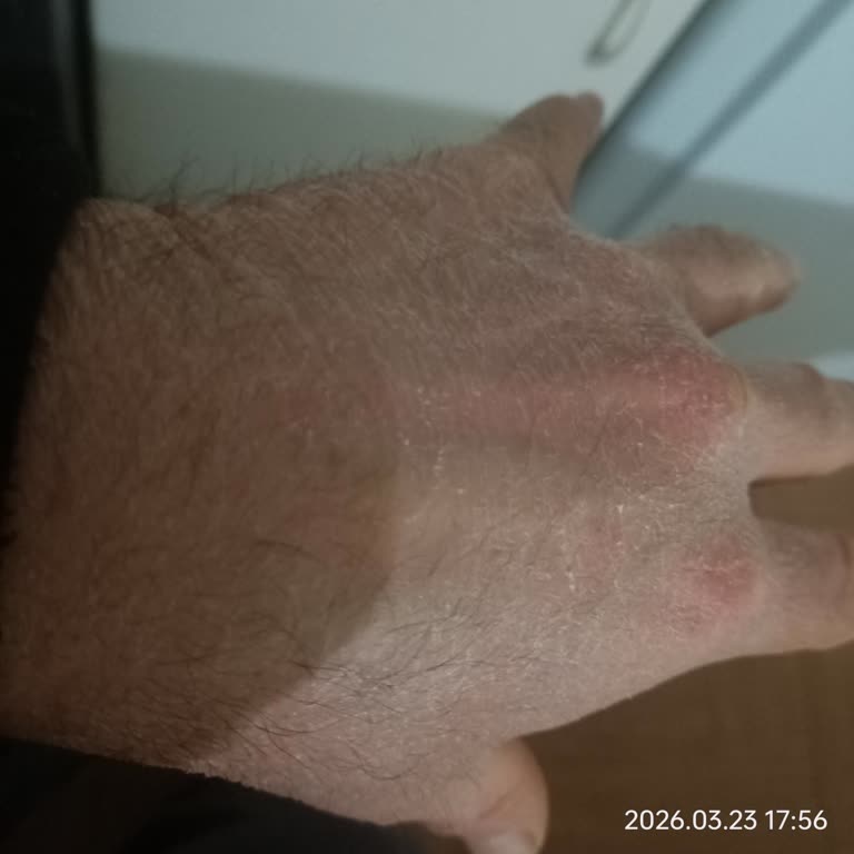 ABC Deterjanı Tahriş Yapıyor