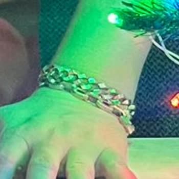 Ema Jewellery Üründe Üretim Ya Da Kalite Kaynaklı Bir Problem Olması