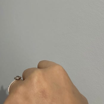 Ayıplı Lazer Epilasyon Ve Haksız Ödeme Talebi