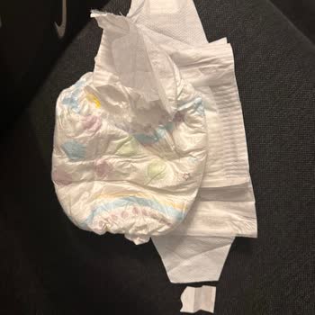 Molfix Bebek Bezlerinde Bant Kopması