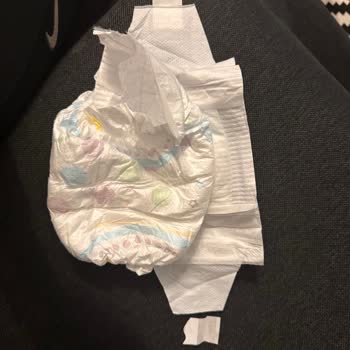 Molfix Bebek Bezlerinde Bant Kopması